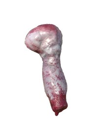 photo-thumb