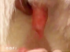 Thumb 18