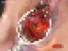 Thumb 10